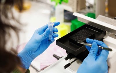 Biologin bakom anorexia nervosa i fokus för forskare