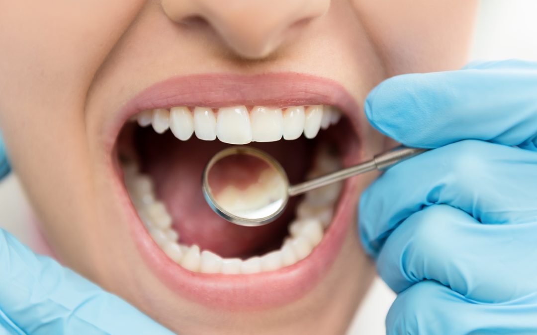 Den vanligaste myten om tandimplantat: ”Tror man är oövervinnerlig”